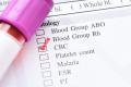 شاخص های (اندکس های) خونی مورد سنجش در آزمایش CBC
