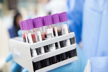 تشخیص سریع ۵۰ نوع سرطان با یک آزمایش خون ساده